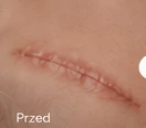 Blizna po zabiegu · 02 — Przed (Przykłady demonstracyjne)